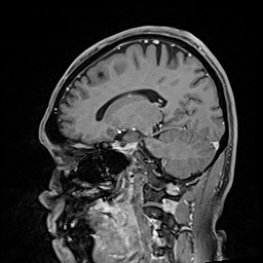 Click on the Serie image to view the images of VILLANUEVA, WILLIAM A.